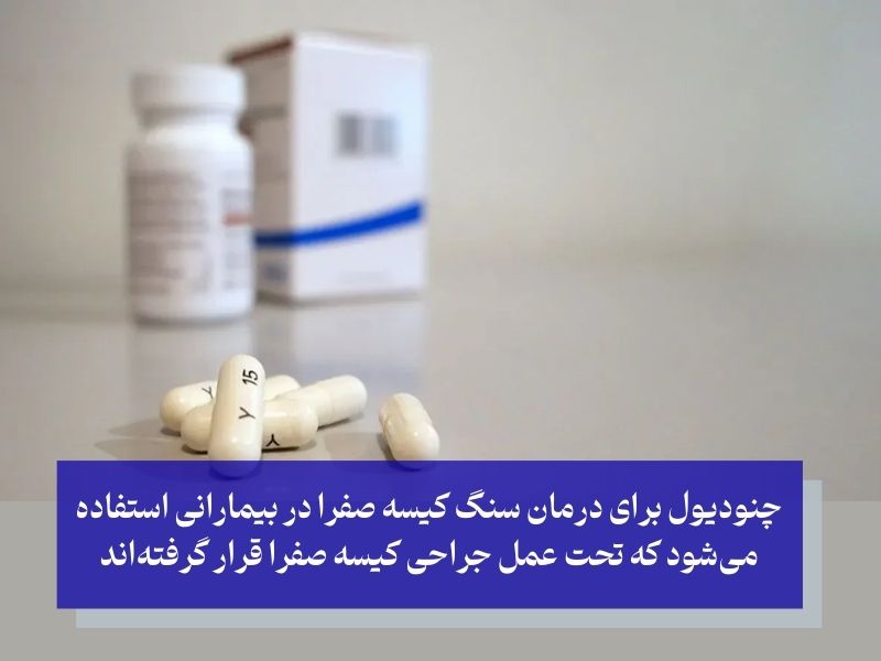 chenodiol قرص سنگ شکن کیسه صفرا