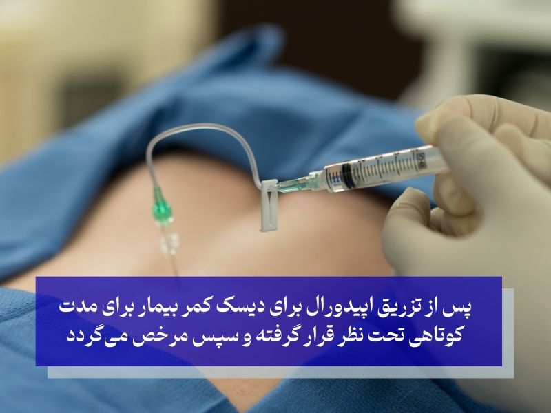 مراحل تزریق اپیدورال کمر