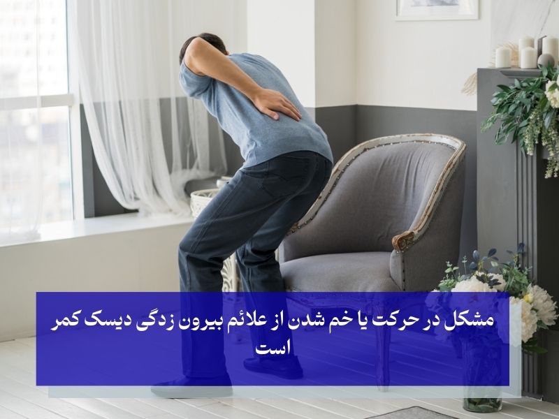 علائم بیرون زدگی دیسک کمر