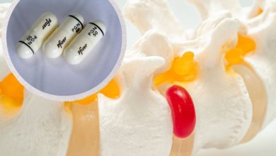 کپسول پرگابالین 50 برای دیسک کمر