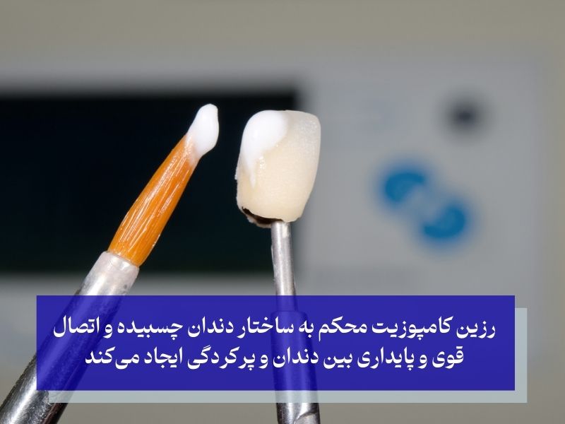 مرحله چسباندن رزین کامپوزیت