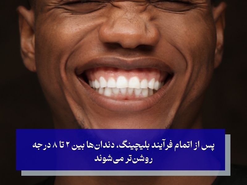 فرآیند علمی بلیچینگ چگونه است