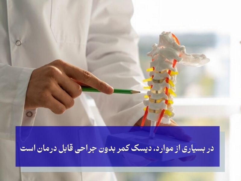 نسخه درمان قطعی دیسک کمر بدون عمل جراحی