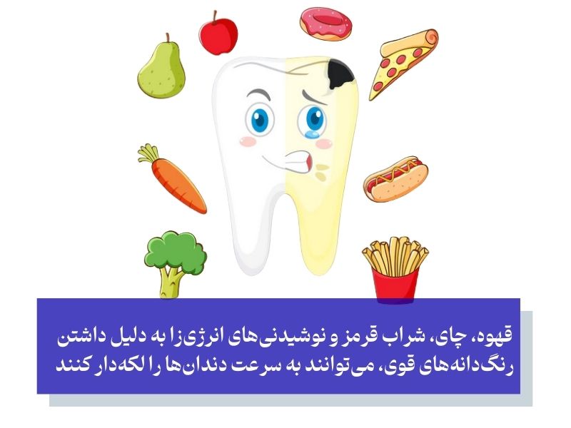 چرا نتایج بلیچینگ زودتر از حد انتظار از بین می‌رود