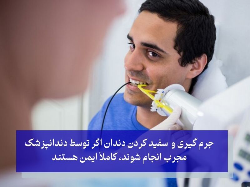 آیا جرم‌ گیری یا سفید کردن دندان عوارض دارد؟