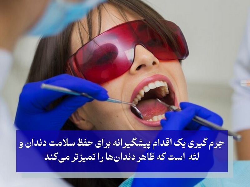 اهمیت جرم‌ گیری دندان چیست