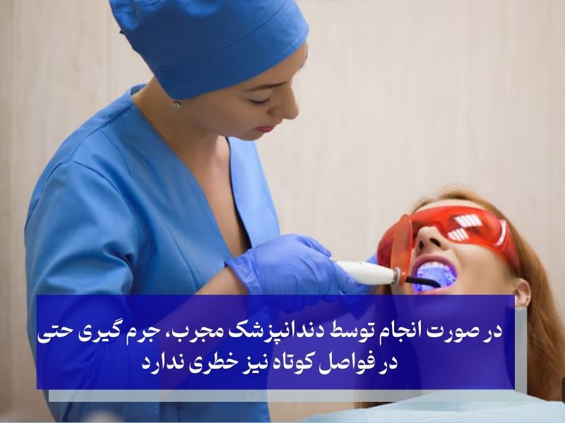 تاثیر جرم ‌گیری مداوم بر سلامت دندان‌ها