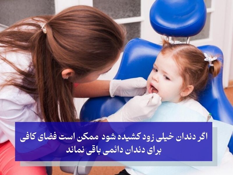 تاثیر کشیدن دندان شیری بر دندان‌های دائمی