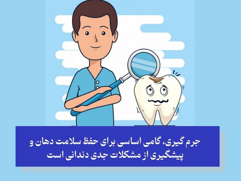 جرم ‌گیری دندان چیست؟