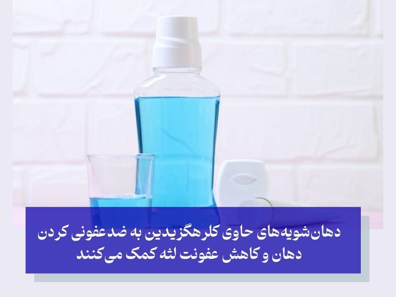 درمان‌های تخصصی پزشکی برای عفونت لثه کودکان