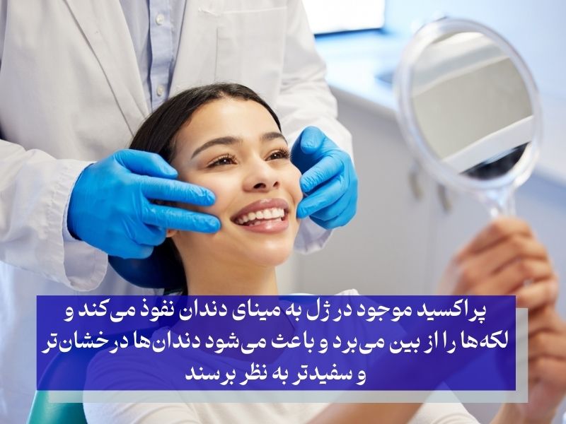 سفید کردن دندان‌ها