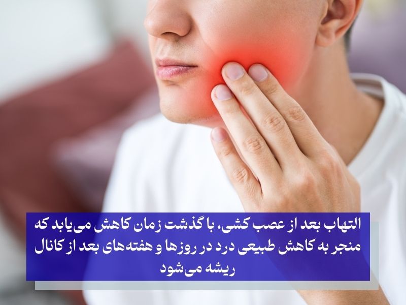 شایعترین علت درد بعد از عصب کشی