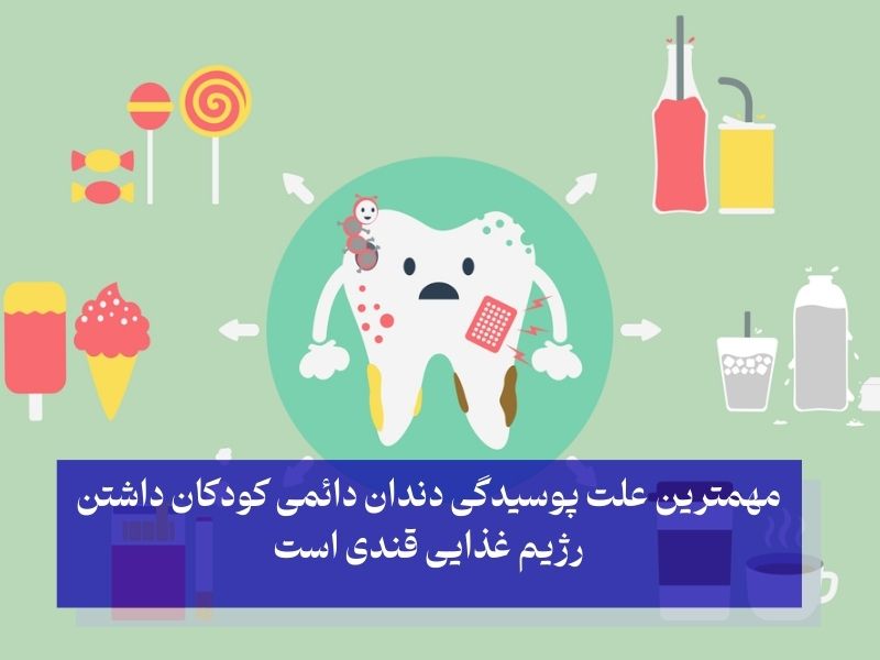 علت پوسیدگی دندان کودکان