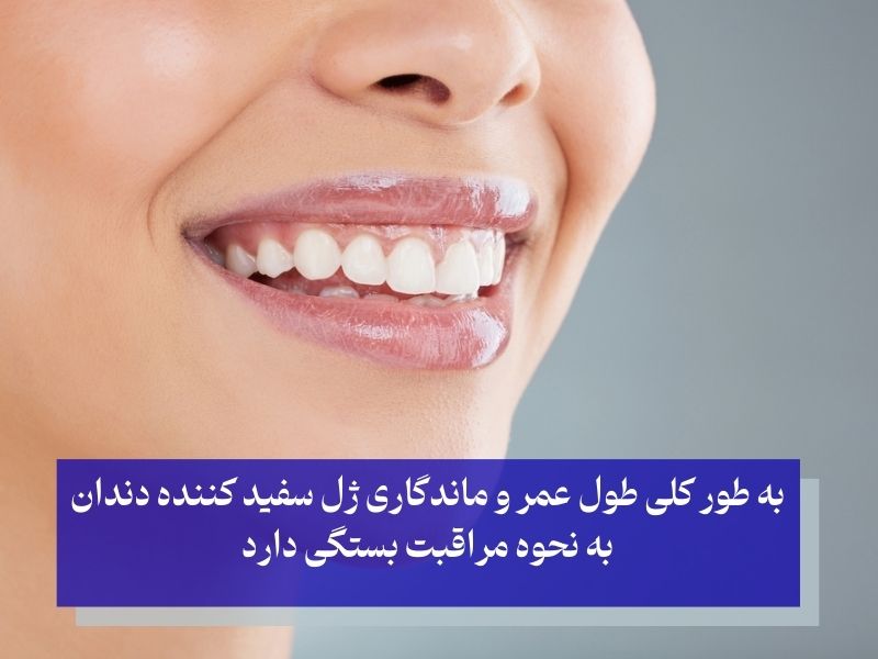 ماندگاری ژل سفید کننده