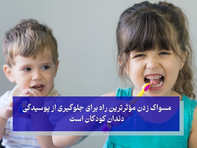 مسواک زدن کودکان برای جلوگیری از پوسیدگی دندان