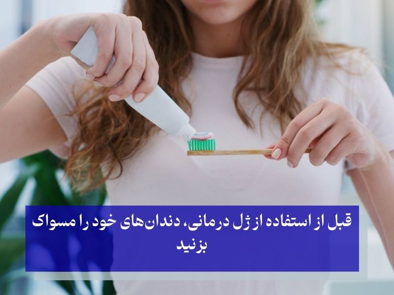 نحوه استفاده از ژل سفید کننده دندان فوری