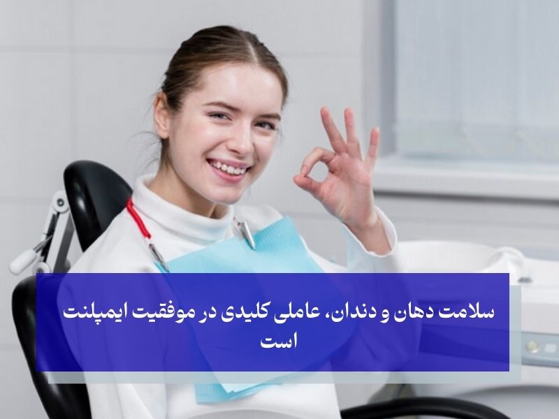 نکات کلیدی برای انتخاب زمان مناسب ایمپلنت