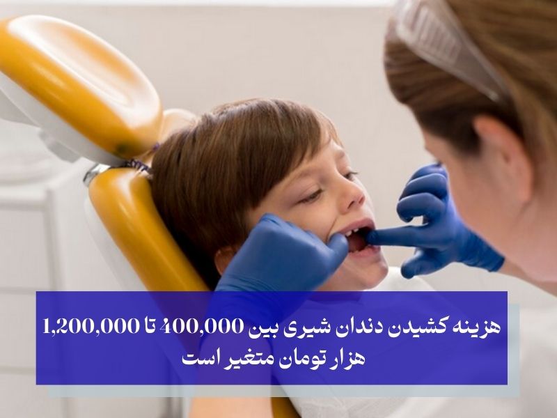 هزینه کشیدن دندان شیری