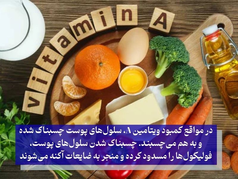 ویتامین کمبود آ