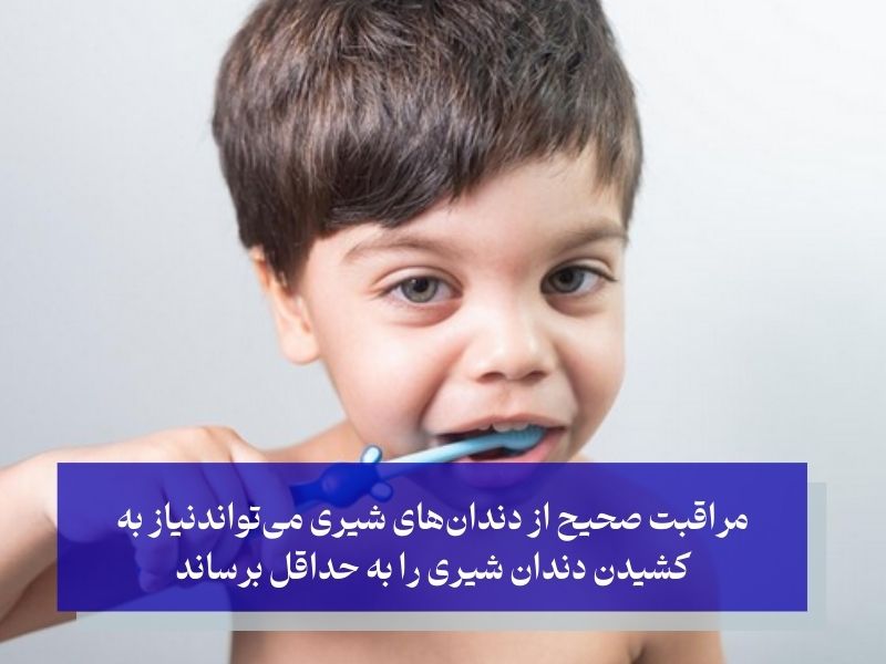پیشگیری از نیاز به کشیدن دندان شیری