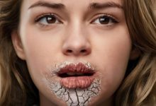 چه بیماری هایی باعث خشکی دهان میشود