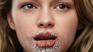 چه بیماری هایی باعث خشکی دهان میشود