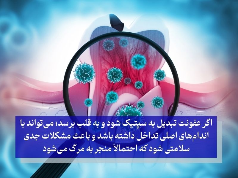 چه زمانی عفونت دندان تهدیدکننده زندگی است