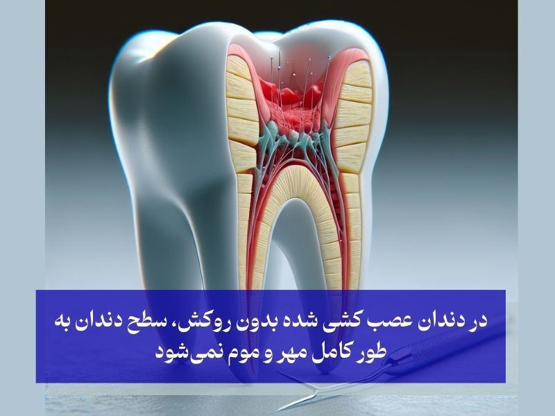 دندان عصب کشی شده بدون روکش