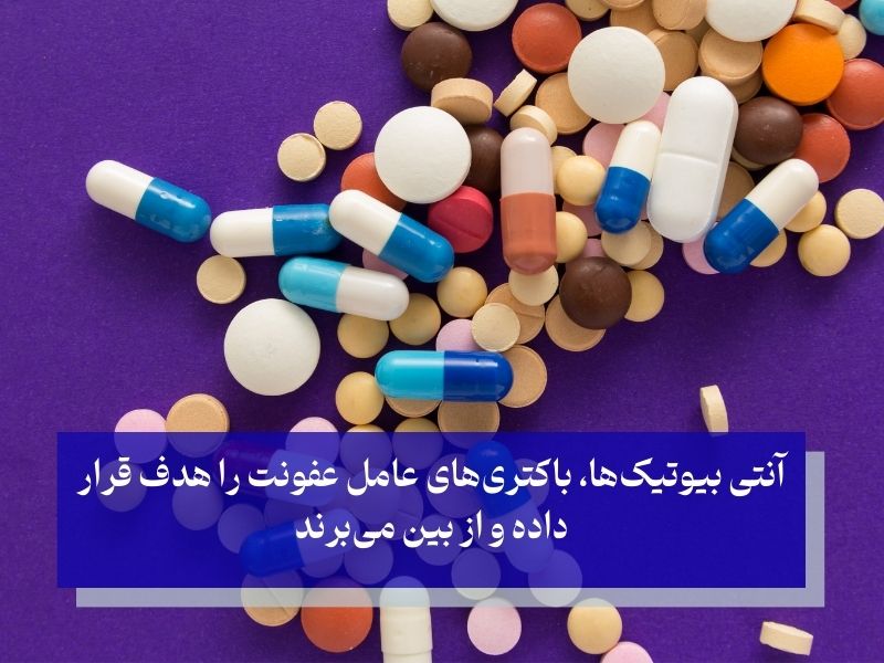 آنتی بیوتیک برای درمان عفونت لثه بعد از کشیدن دندان