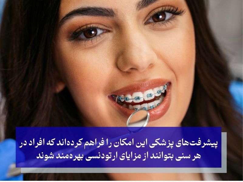 ارتودنسی تا چند سالگی جواب میده