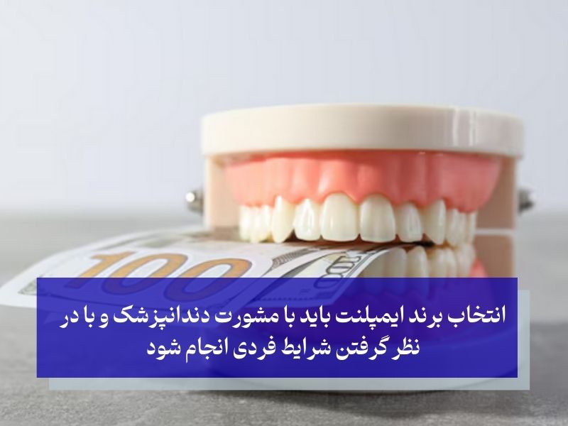 بررسی برندهای ایمپلنت