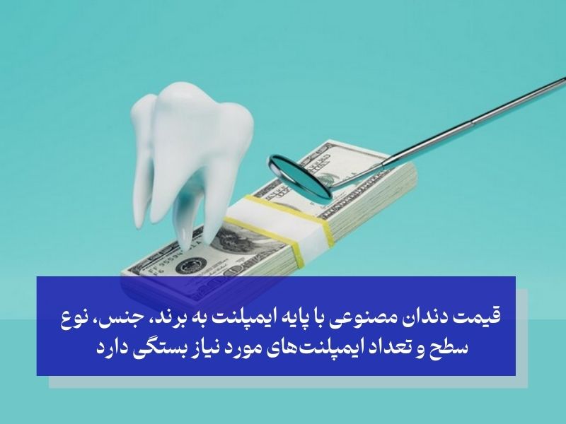 بررسی دقیق قیمت دندان مصنوعی ثابت بر پایه ایمپلنت؛ سفری از ایمپلنت تا پروتز