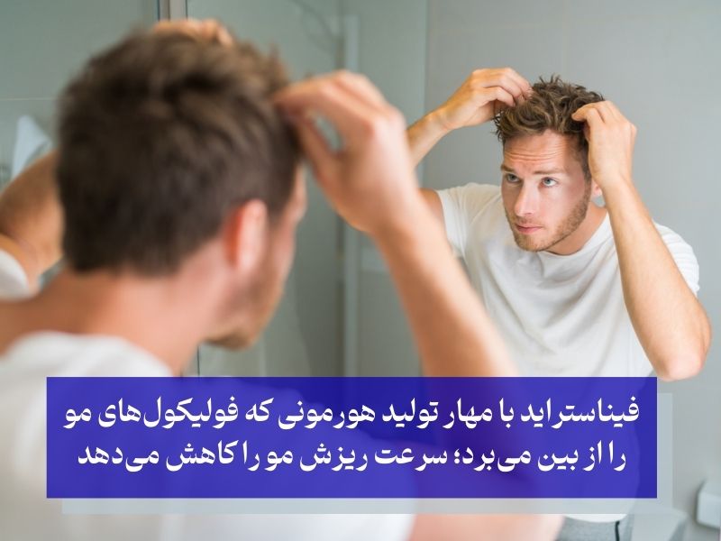 بهترین قرص برای پرپشت شدن مو مردان