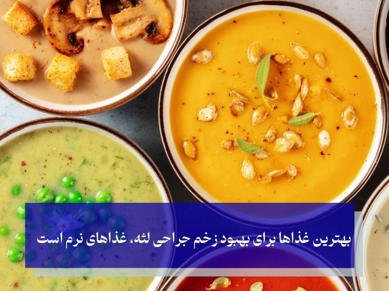 تغذیه مناسب در مراقبت های بعد از جراحی لثه