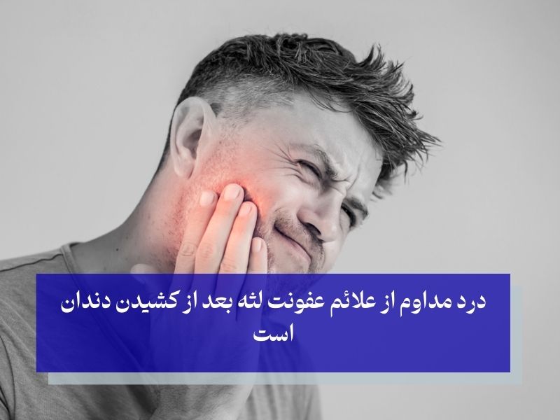 علائم عفونت لثه بعد از کشیدن دندان