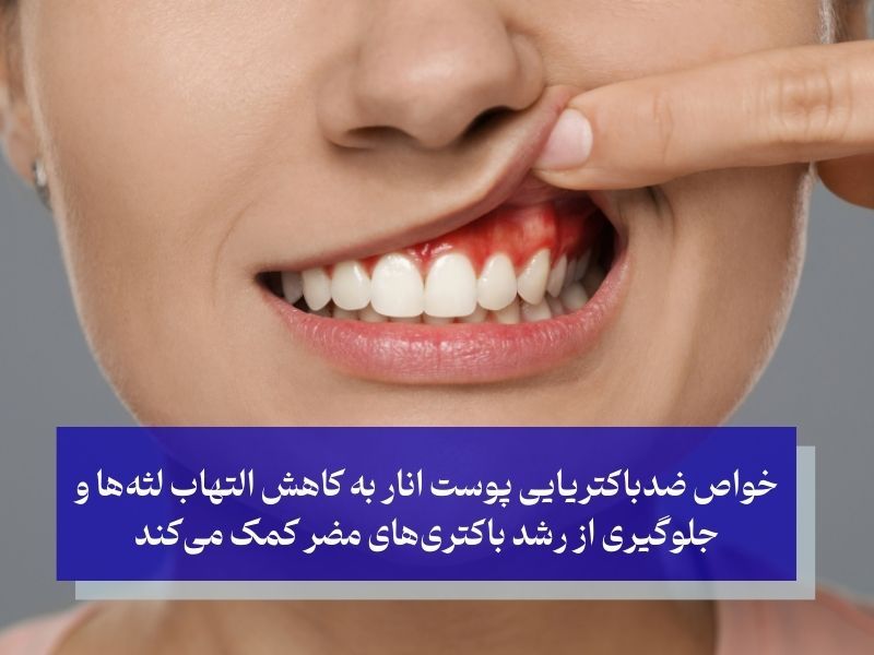 روش‌های استفاده از پوست انار برای عفونت دندان و لثه