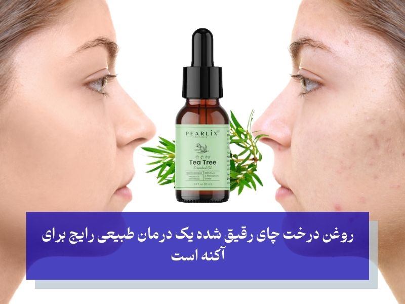 روغن درخت چای برای جای جوش