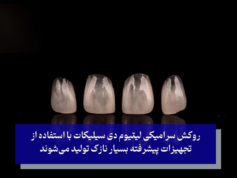 روکش سرامیکی لیتیوم دی سیلیکات