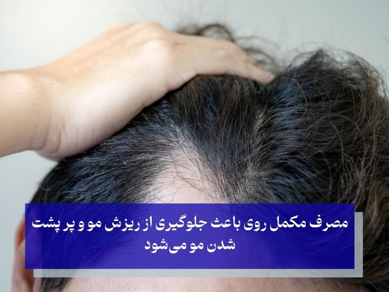 روی و پر پشت شدن مو