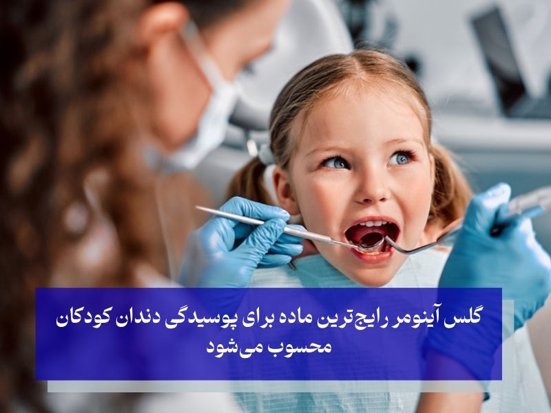 شایع‌ترین ماده پرکننده برای دندان‌های کودکان