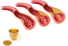 عرقیات مفید برای کاهش چربی خون