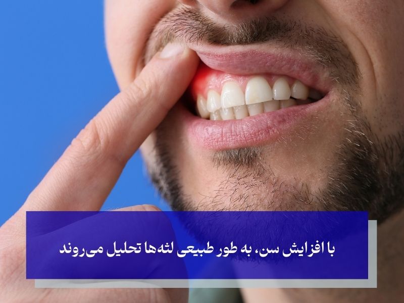 علل اصلی تحلیل لثه