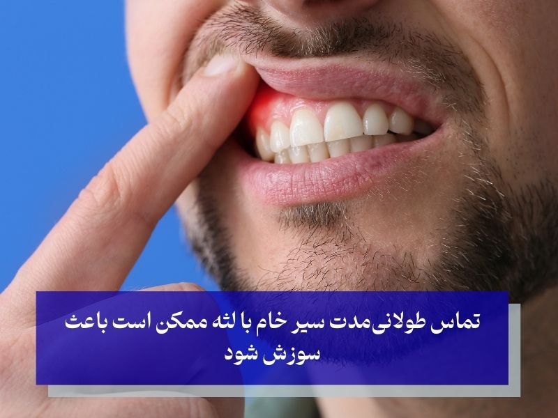 عوارض جانبی احتمالی استفاده از سیر