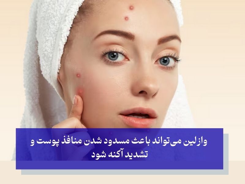 عوارض جانبی احتمالی وازلین