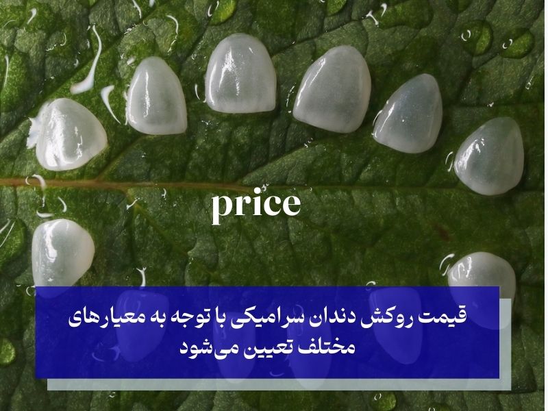قیمت روکش دندان سرامیکی