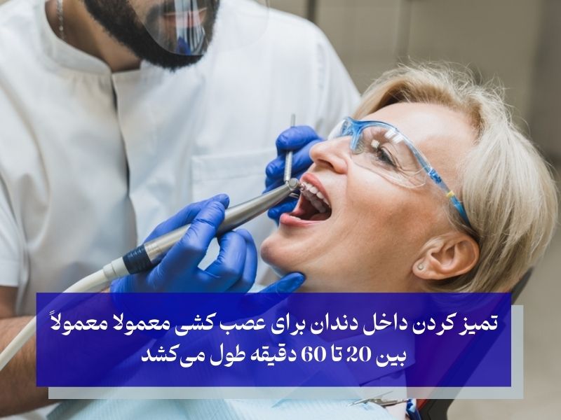 مدت زمان تمیز کردن داخل دندان برای عصب کشی