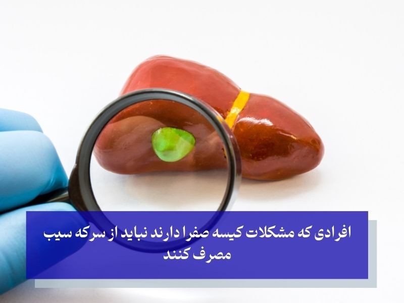 مشکلات کیسه صفرا و منع مصرف سرکه سیب