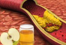 نحوه مصرف سرکه سیب برای چربی خون