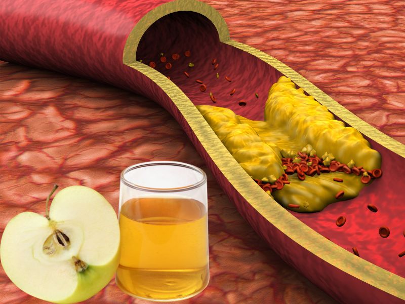 نحوه مصرف سرکه سیب برای چربی خون