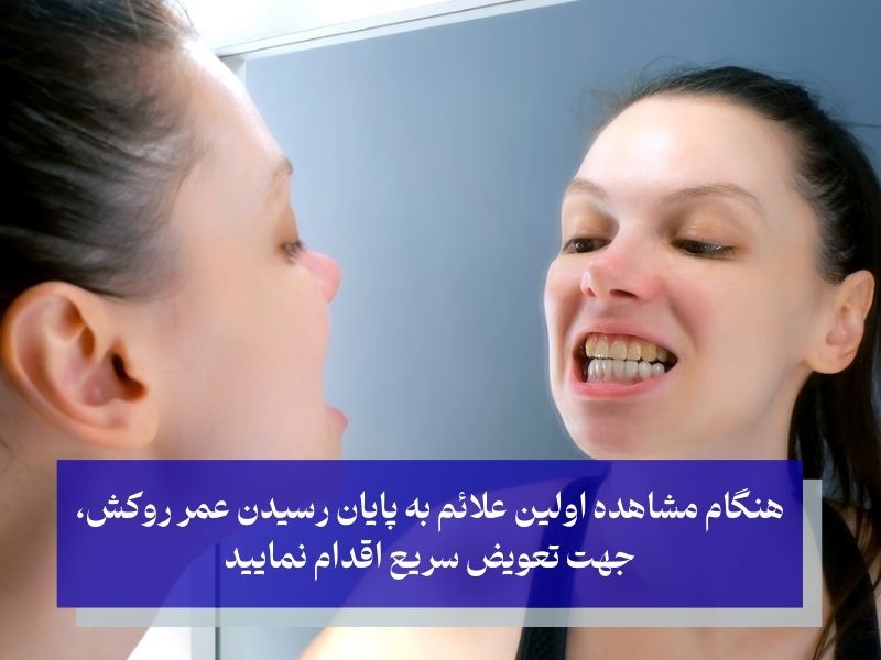 ه پایان رسیدن طول عمر دندان روکش